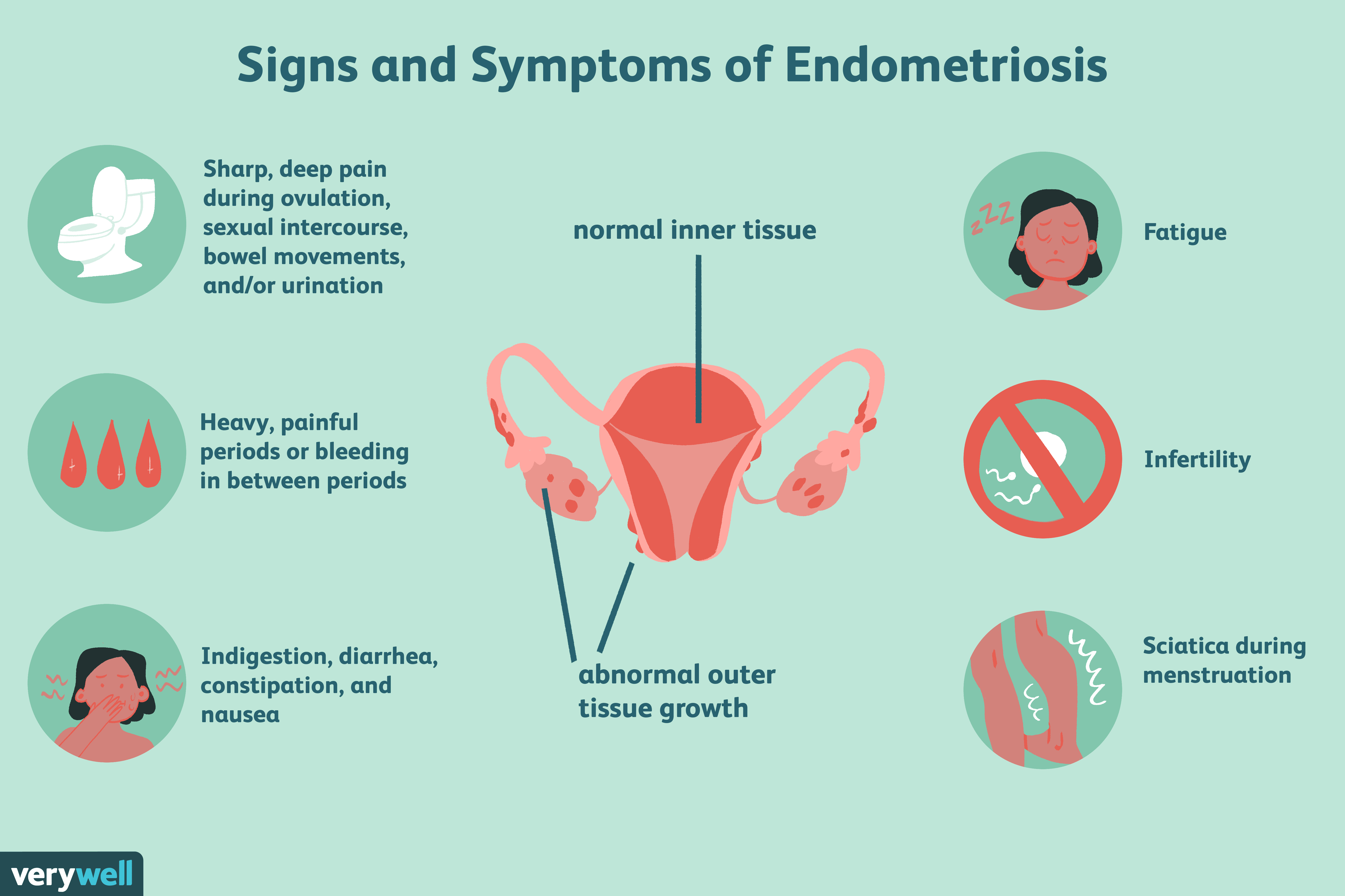 natural treatments for endometriosis  redraw color cebefbdac