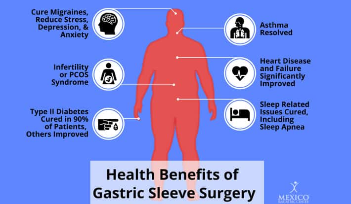 Health Benefits of Gastric Sleeve Surgery Infographic