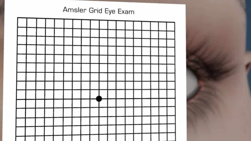 What Is An Amsler Grid Understanding The Eye Test For Macular Degeneration