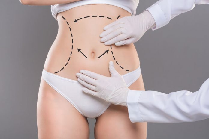What Is The Difference Between Liposuction And Tummy Tuck