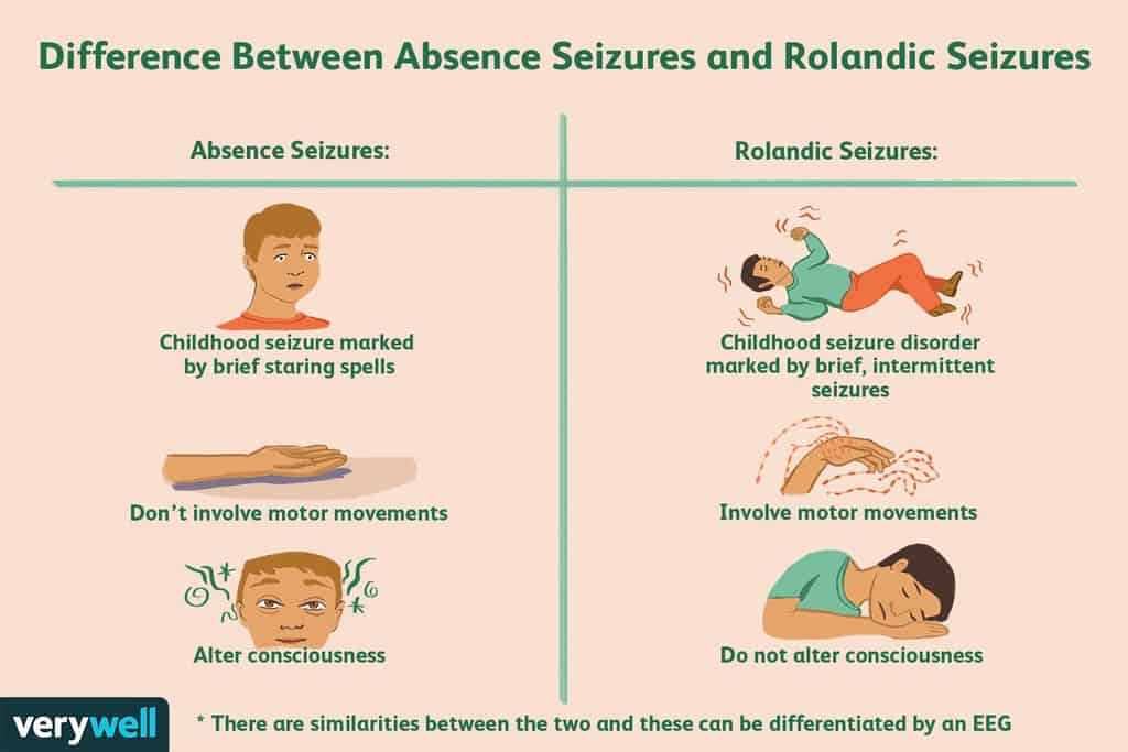 rolandic epilepsy symptoms causes diagnosis and treatment  v ccafcadcbbcce